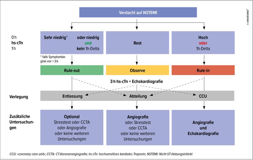 Der Hs-cTn-0/1h-Algorithmus Zur Raschen Diagnostik Des Myokardinfarkts ...